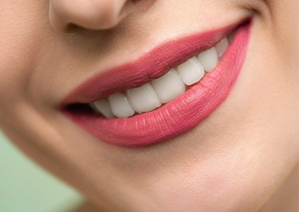 Absolème détarteur dentaire ultrason