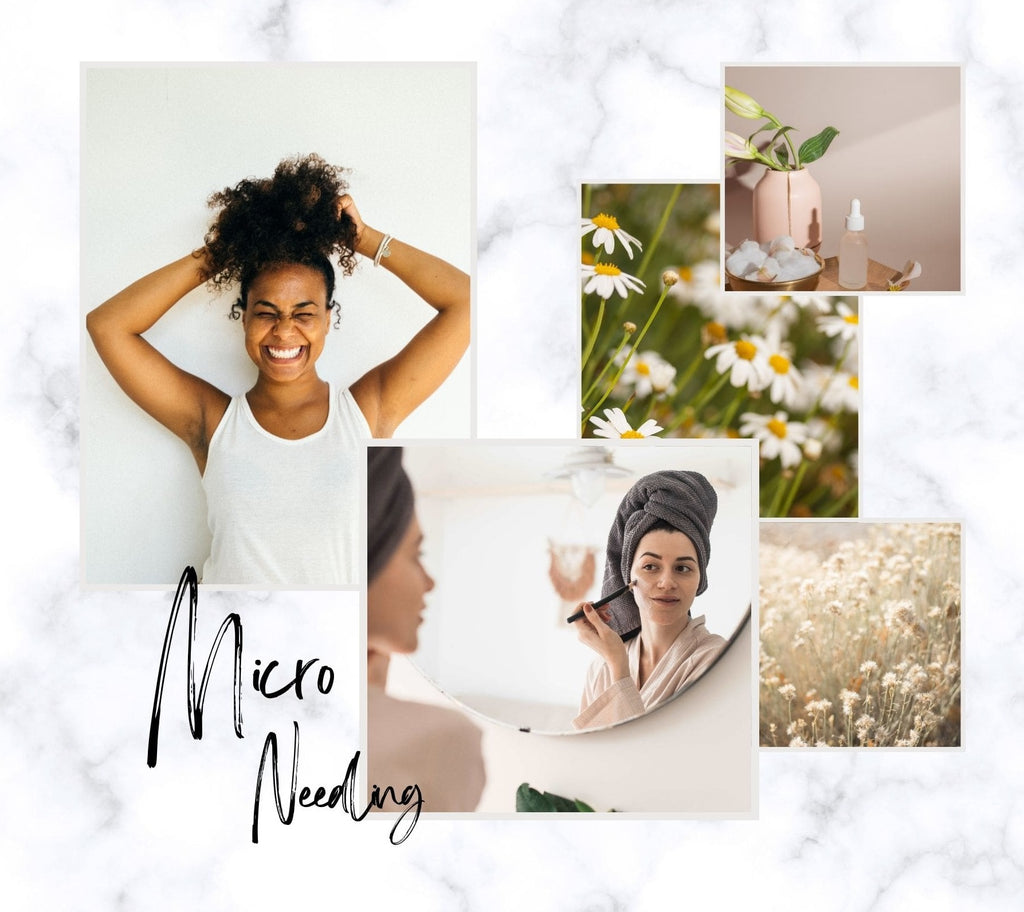 Absolème les bienfaits du micro needling